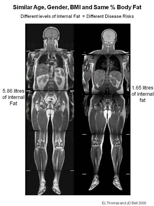 What Type of Body Fat Are You Storing?