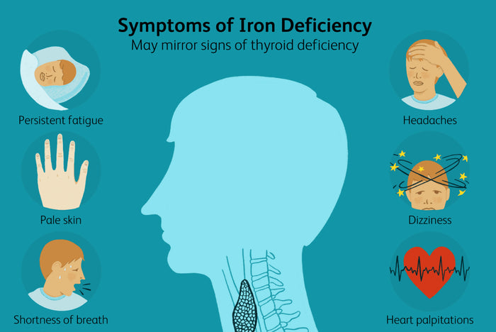 What you need to know about IRON