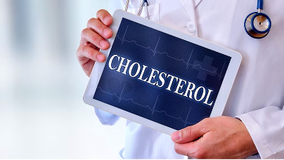 Fluctuating Cholesterol, Triglycerides Tied to Increased Dementia Risk
