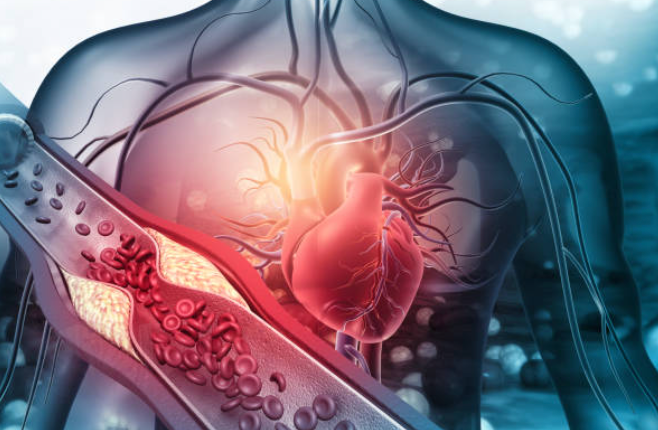Your Heart Health: what you need to know