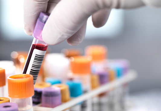 Why Blood Pathology Ranges Aren’t the Whole Story for Your Health