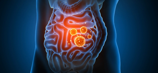 Managing Small Intestinal Bacterial Overgrowth (SIBO)