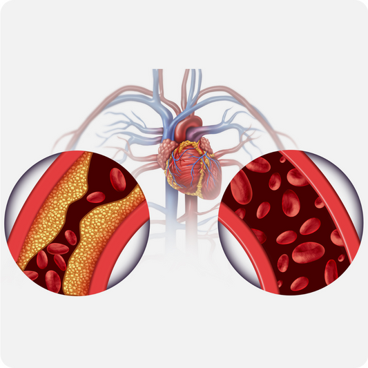 Insulin Resistance: The Hidden Risk Factor for Cardiovascular Disease