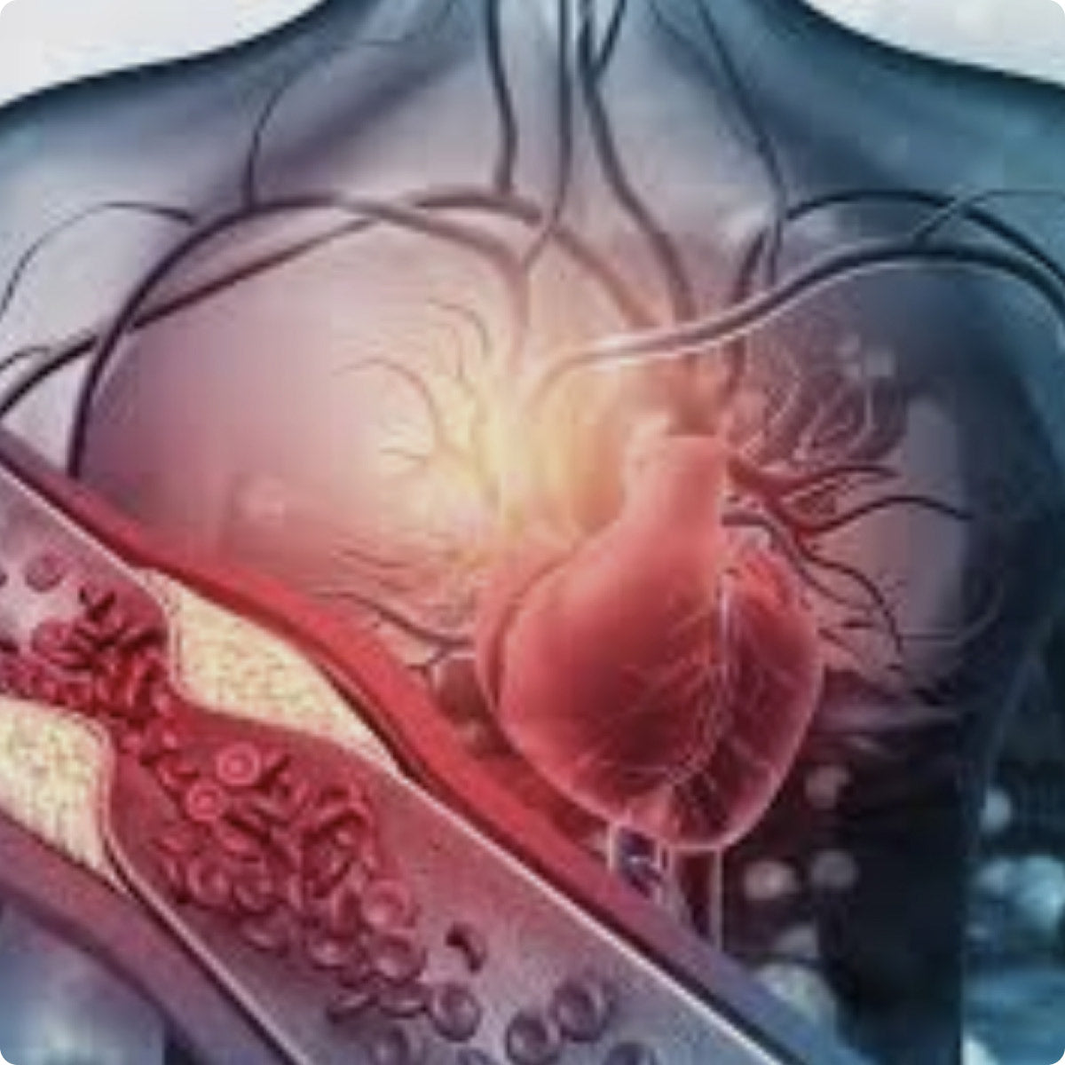 My Cardiovascular Screening